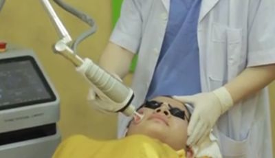 điều trị sẹo lồi567