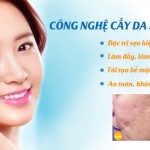 Chia sẻ địa chỉ thẩm mỹ viện trị sẹo lõm uy tín