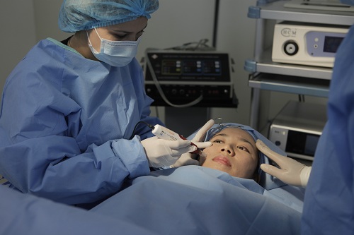 San phẳng sẹo rỗ tới 90% chỉ sau 1-2 lần trị liệu