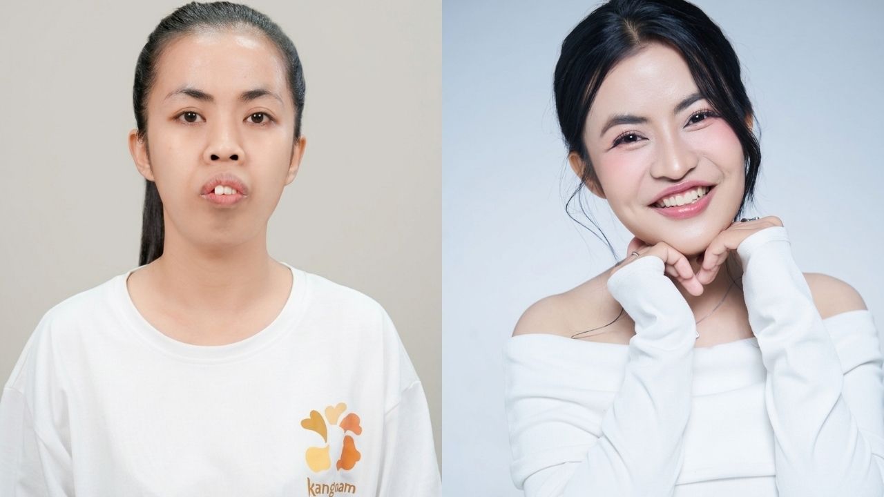 Trà My đã có màn lột xác thành công, khuôn mặt cân đối hài hòa